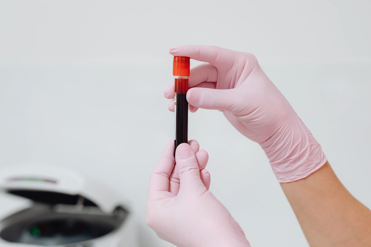 Vip elderly b12 deficiency in seniors